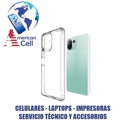 CARCASA - TRANSPARENTE - MI 11 LITE
